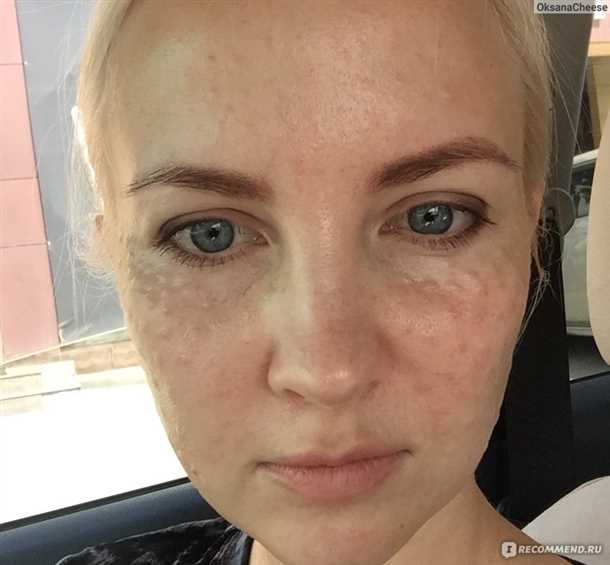 Уход в течение первых нескольких дней