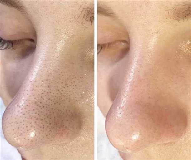 Вредные привычки и неподходящая косметика