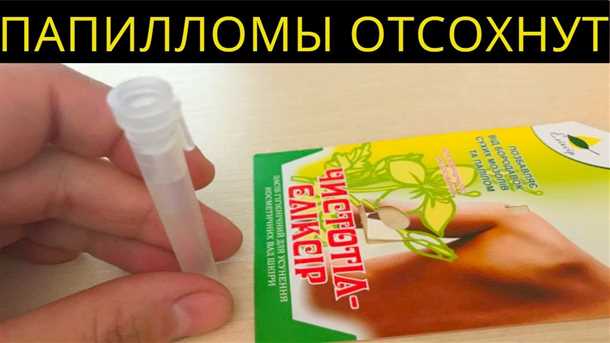 Причины и виды папиллом